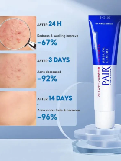 Lion Pair Acne Cream W benefits