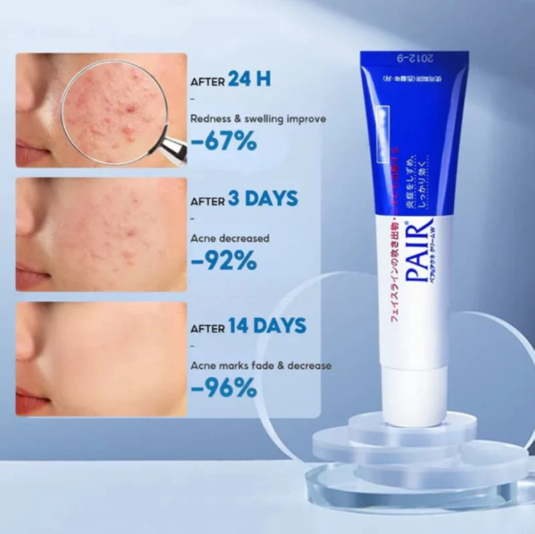 Lion Pair Acne Cream W benefits